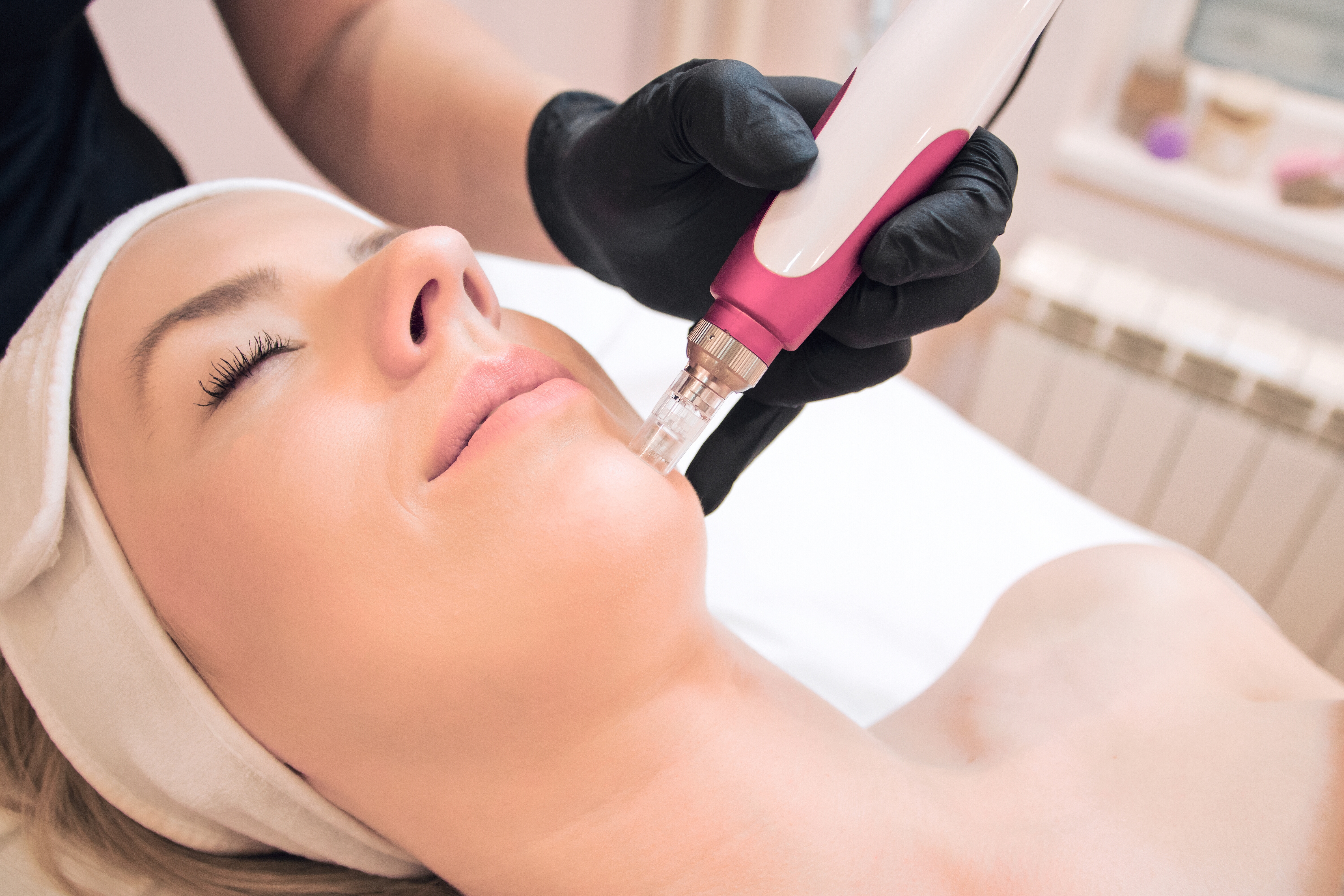 Micro needling